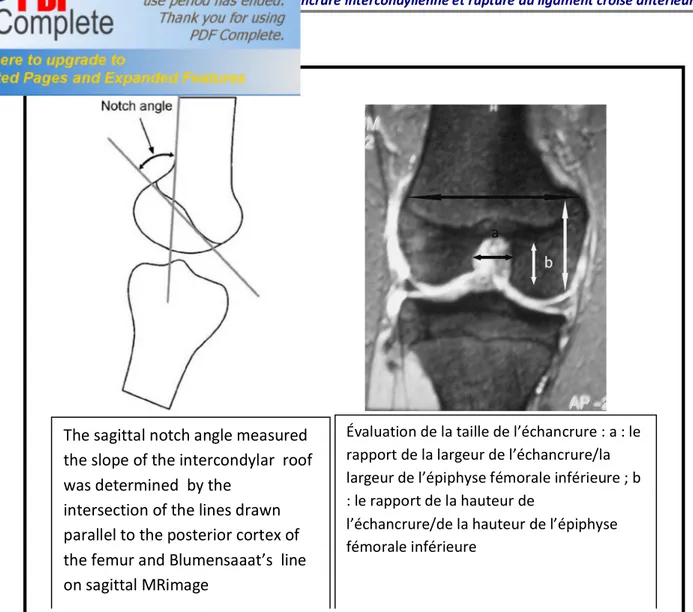 Figure 13 montrant les mensurations des hauteur, largeur et angle sagittal de l’EIC. 13-24 