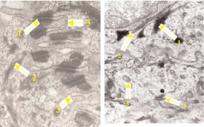 Fig. 6. Les kératinocytes de la couche  spineuse de l’épiderme 