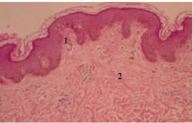 Fig. 20. Le derme 