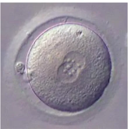 Figure 2 : zygote au stade de deux pronucléi[13]    