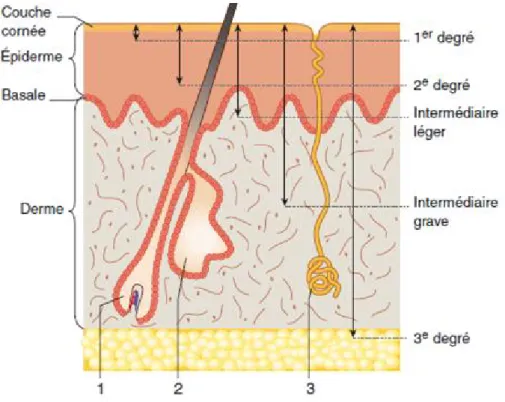 Figure  4 : Histologie  de  la  peau  et  de  la  profondeur  de  la brûlure. 1, Poil, 2, glande sébacée, 3, glande sudoripare [84].