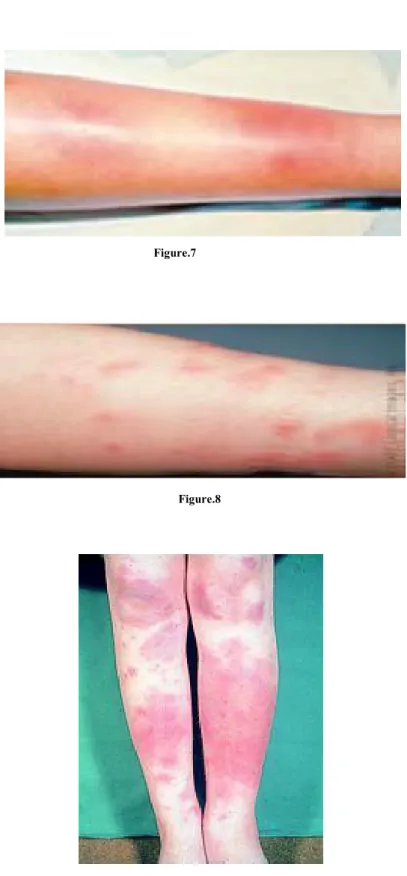 Figure 7 à 9 : Aspects cliniques 