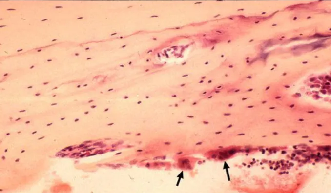 Figure 5: Ostéoclaste impliqué dans la résorption osseuse [29]. 
