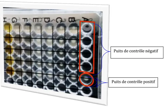 Figure 5: Validation d’une microplaque après 24h d’incubation 