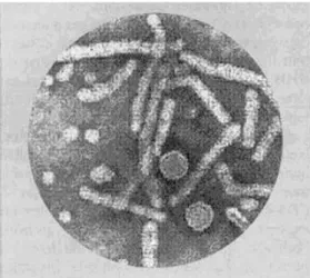 Figure 1 : Virus de l'hépatite B vu en microscopie électronique. 14