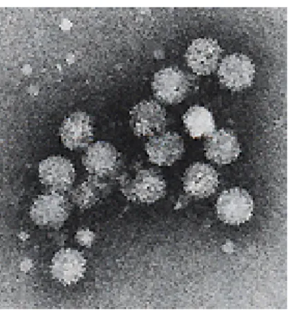 Figure 3 : Virus de l'hépatite C vu en microscopie électronique. 18
