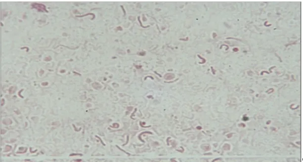 Figure 3: Examen microscopique d’une culture après coloration de Gram : H. pylori  apparaît sous diverses formes : bacillaire, incurvé, en U, en C ou en O  