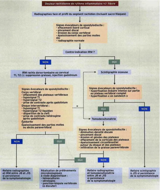 Figure 1 : Arbre décisionnel d’imagerie pour diagnostic de SDI [27] 