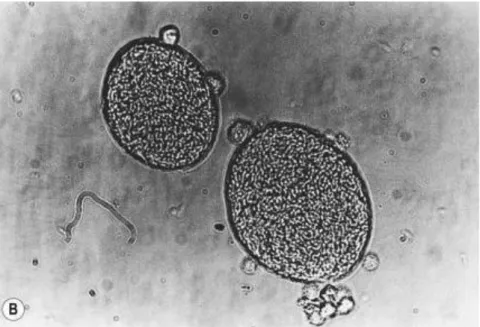 Fig n°3 : les kystes de Toxoplasma contenant un grand nombre de tachyzoïtes 