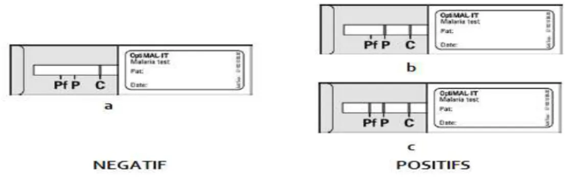 Figure 4 : Interprétation du TDR (OptiMal-IT)  (a) Réaction négative: Pas de pLDH détectable dans l'échantillon