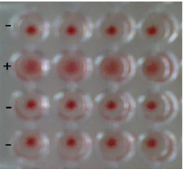 Figure 4: Aspect d’une réaction positive et négative en HAI  