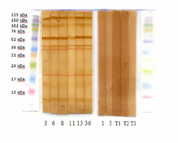 Figure 9 : Profil de séparation électrophorétique  du liquide hydatique sur gel de  polyacrylamide à 10%