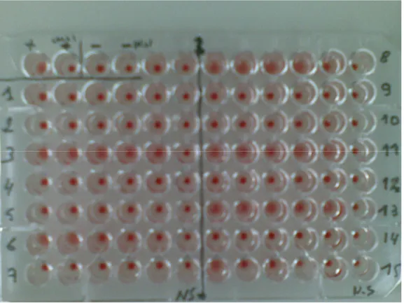 Figure 10: exemple de résultat d’HAI obtenu sur plaque de microtitration pour les 15  premier sérums 