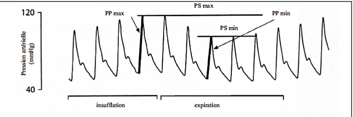 Figure 7 : Effets des variations cycliques des pressions intrathoraciques induites   par la ventilation mécanique sur les conditions de charge ventriculaire  