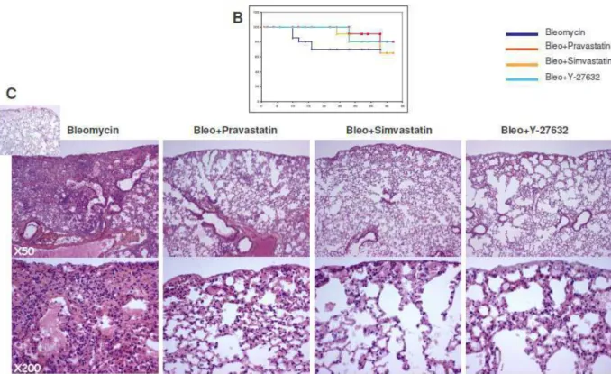 Fig.  13:  Reversion  of  bleomycin-induced  pulmonary  fibrosis.  B.  Monitoring  of  the  survival  rates