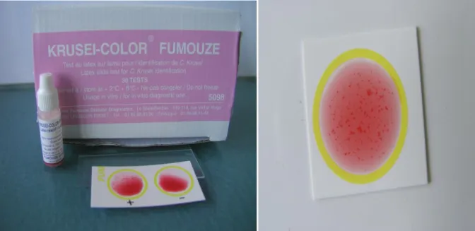 Figure 10 . Kit Krusei-Color® : [Photo du service de Parasitologie Mycologie, Hôpital  Militaire d’Instruction Mohammed V, Rabat] 