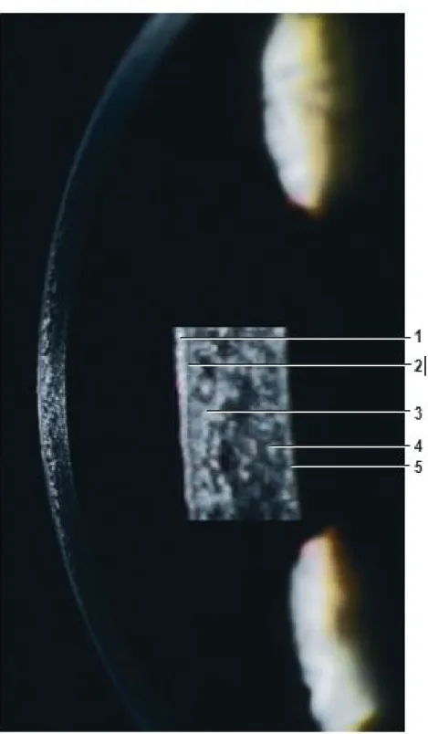 Figure 2 : Vue en lampe à fente mince de la cornée normale [16]. 