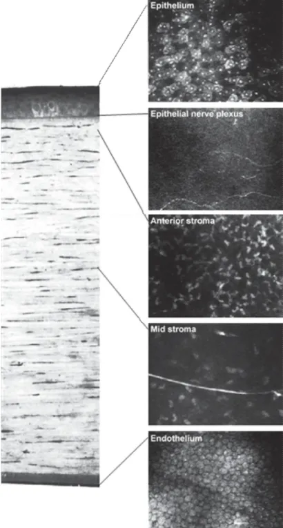 Figure 3 : Microscopie confocale de la cornée normale. À gauche se trouve 