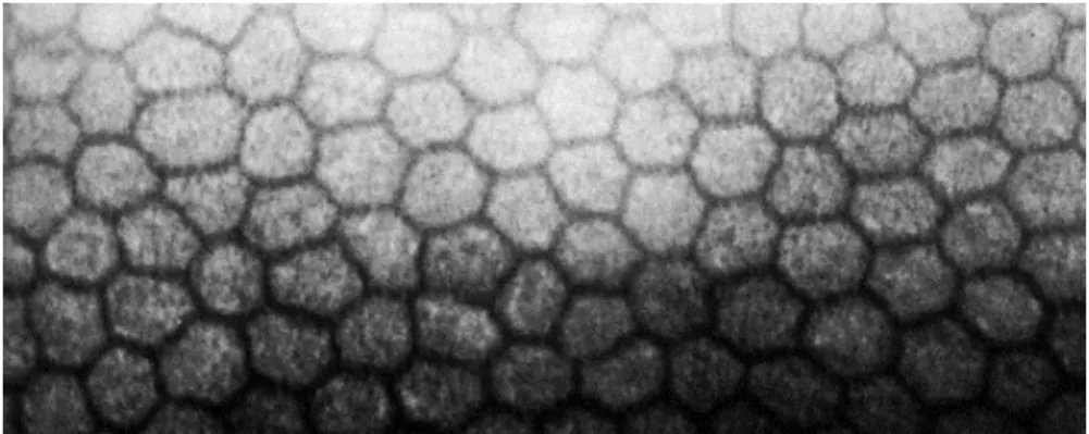Figure 4: Endothélium cornéen normal par microscopie spéculaire. 