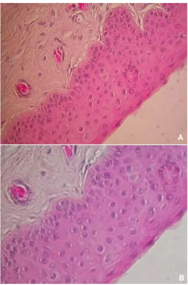 Figure 5: Photographie en microscopie optique coloration hématoxiline,   éosine, safran : épithélium cornéen (A, B).[15]