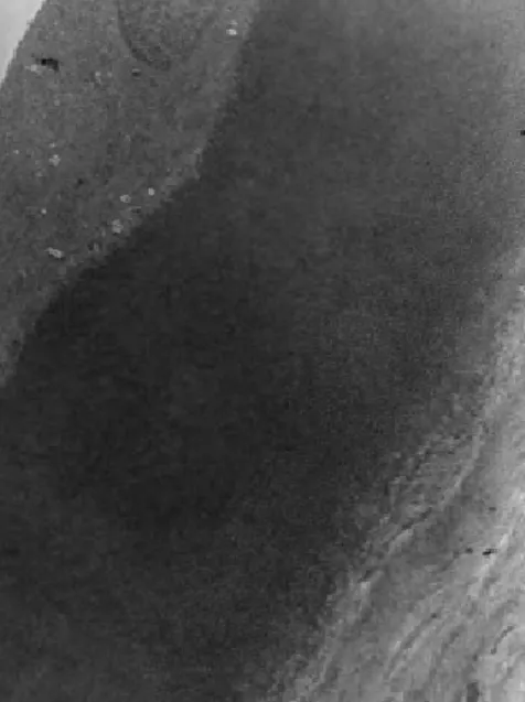 Figure 8:Photographie en microscopie électronique : coupe passant   par stroma puis Descemet puis endothélium × 3 000[15]