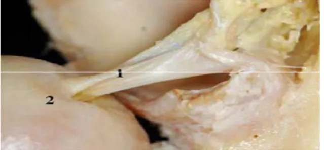 Figure 3 : Vue postérieure de la hanche (tête luxé) [2]. 
