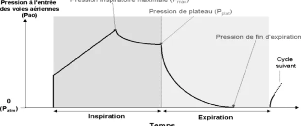 Figure 8: Courbes de pression des voies aériennes en VM 