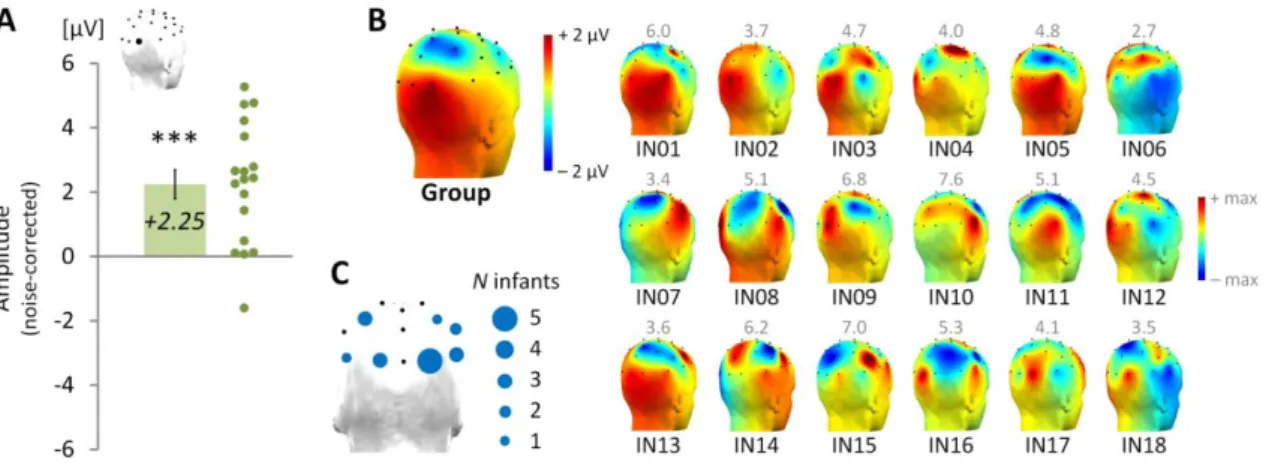 Figure IV-3. Effect of maternal odor cues on the face categorization response recorded in each individual  infant brain