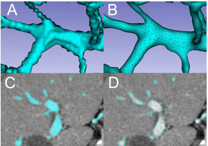 Figure 9. Différence entre un segment (A et C)   et un modèle 3D polygonal (B et D) 