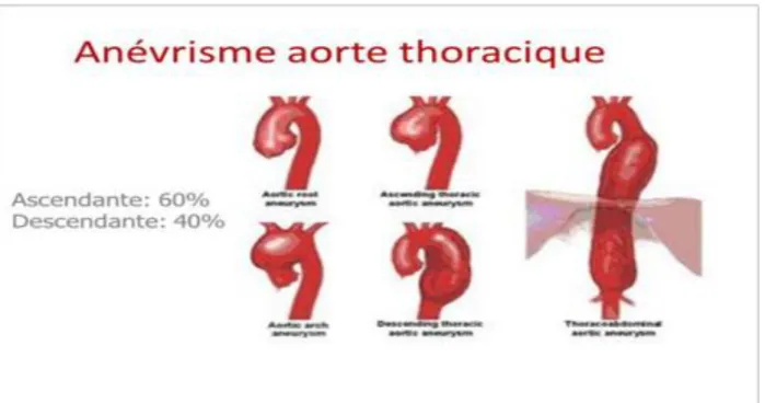 Figure 1 : Aspect général de l’anatomie aortique. 