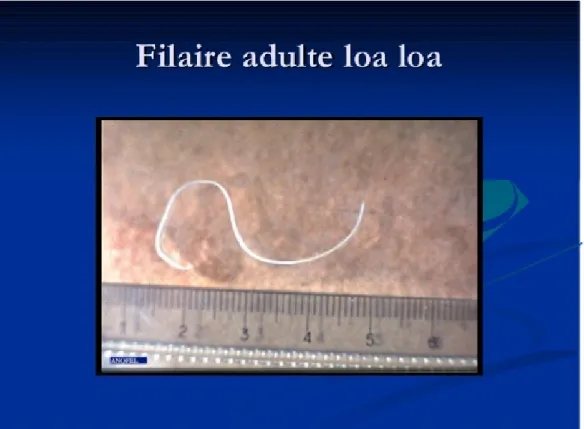 Figure 2 : Filaire adulte Loa loa [1] 