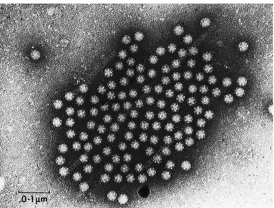 Figure 9 : Astrovirus en microscopie électronique. On distingue la morphologie  caractéristique en étoile des virions [86]