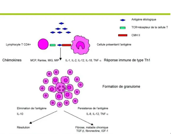 Figure 2 : Modèle hypothétique de l’immunopathogenèse de la sarcoidose. Adapté et modifié       d’après Moller DR