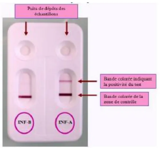 Figure 8 : Test de diagnostic rapide par immunochromatographie  sur membrane [35] 