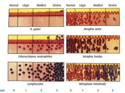 Figure 12 : Classification de système de Sydney [34] 