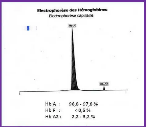 Figure 6 : Profil normal de l’électrophorèse capillaire de l’Hb à pH alcalin. 