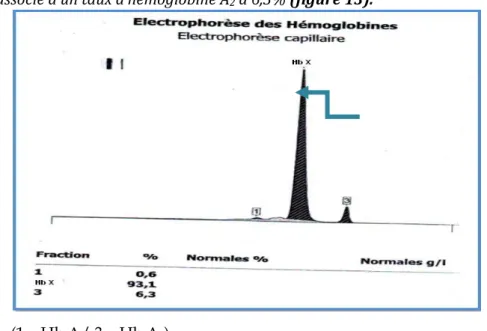 Figure 14 : Résultat de l’électrophorèse de l’Hb du propositus à pH acide. 