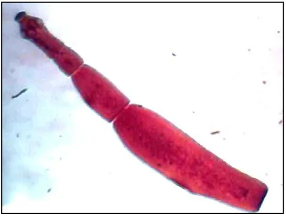 Figure 2 :Aspect microscopique de l’Echinococcus granulosus  [11] . 