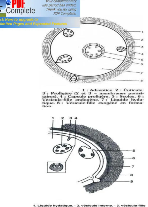 Figure n°13 et 14 : Schéma du  kyste hydatique. 