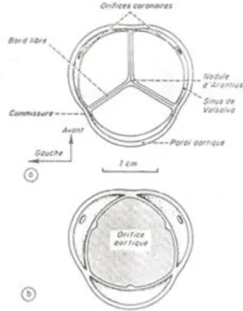 Figure 3 : Disposition des sigmoïdes aortiques : 