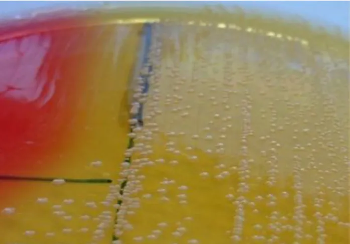 Figure 5 : Culture de staphylocoque aureus sur milieu de CHAPMAN [28] 