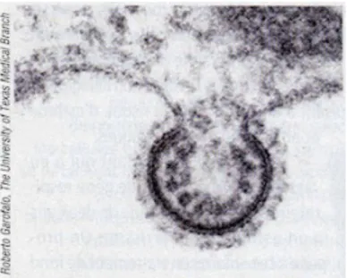 Figure 8:VRS fusionné avec la membrane d’une cellule,   vu en microscope électronique à transmission