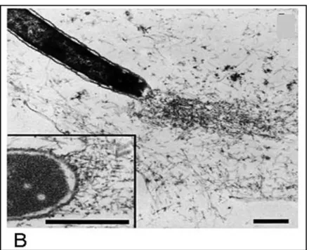 Figure 4  Motilité intracellulaire de Shigella dépendante   de l’actine au Microscope électronique
