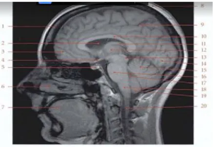 Figure  15 : Imagerie par résonnance magnétique de la tête ; coupe sagittale para-médiane[18] 