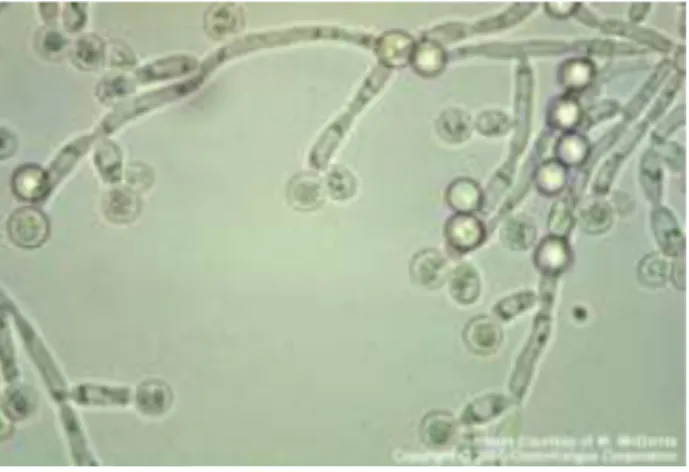 Figure 1: C. albicans [6] 