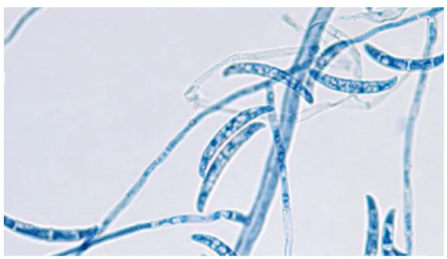 Figure 4 : Fusarium sp [28] 