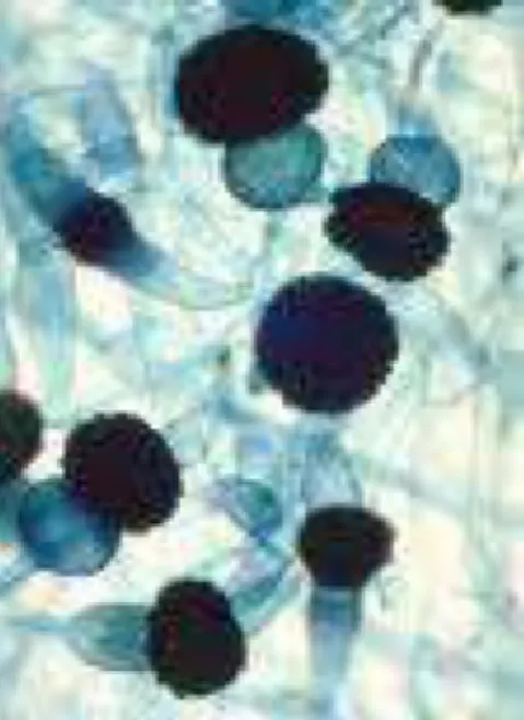 Figure 5 : Rhizopus nigricans [31] 