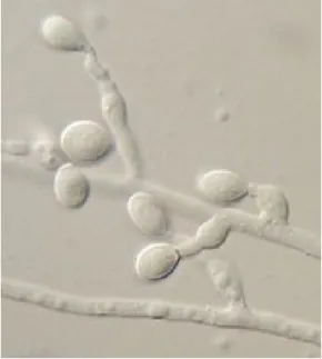 Figure 6 : Scedosporium prolificans [32] 