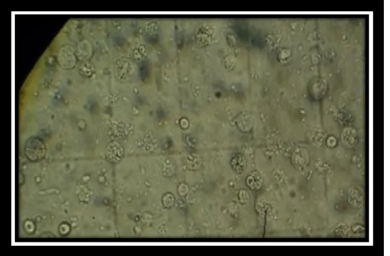 Figure 8 : Leucocytes et globules rouges sur cellule de Malassez observés au 