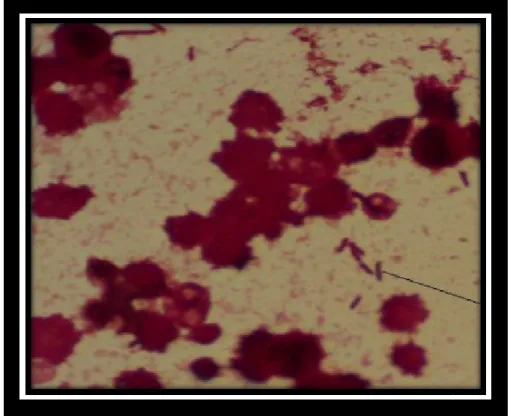 Figure 9 : Coloration de Gram sur culot de centrifugation observé au 